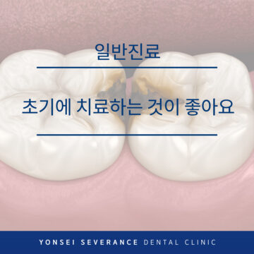 권선구충치치료
