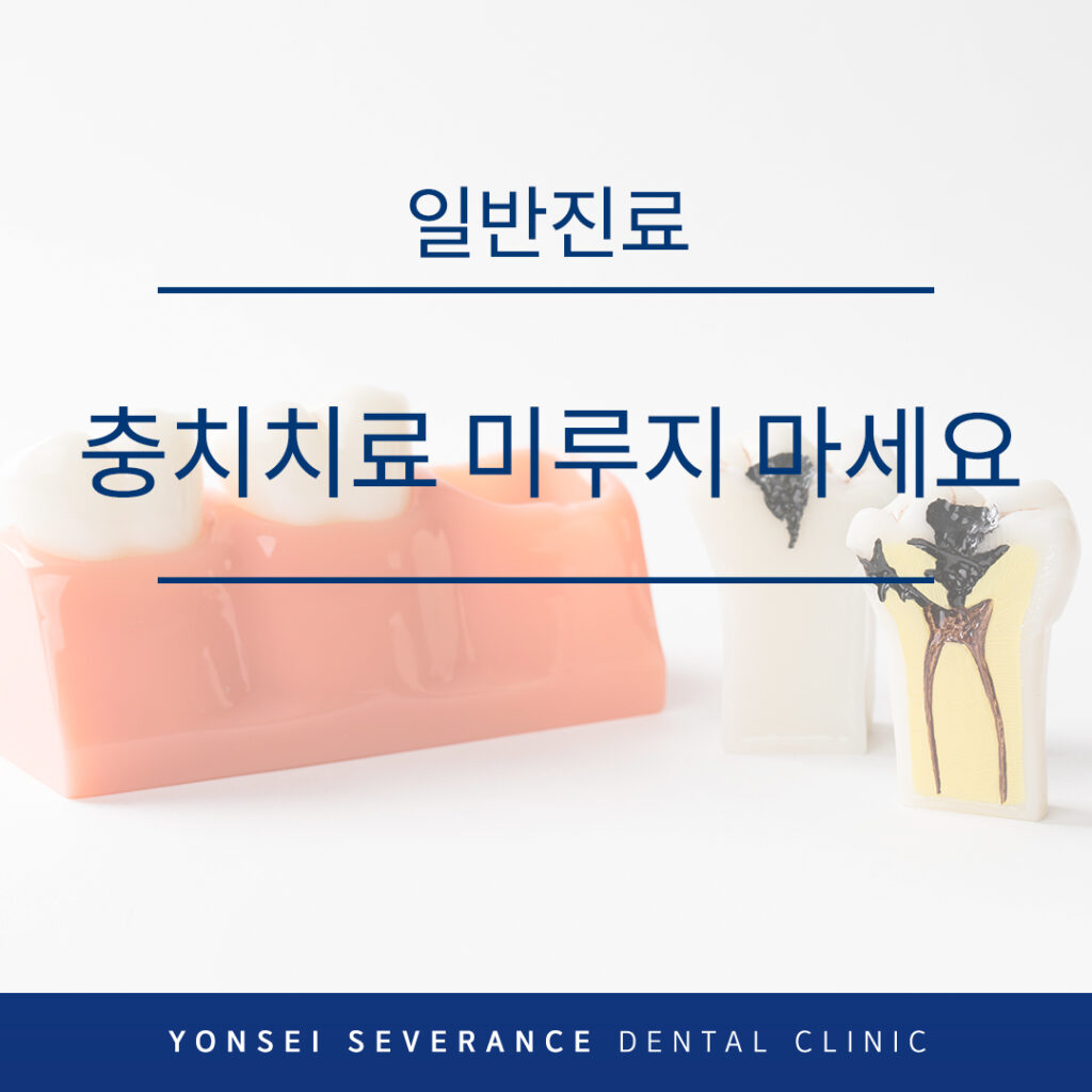 곡반정동충치치료 