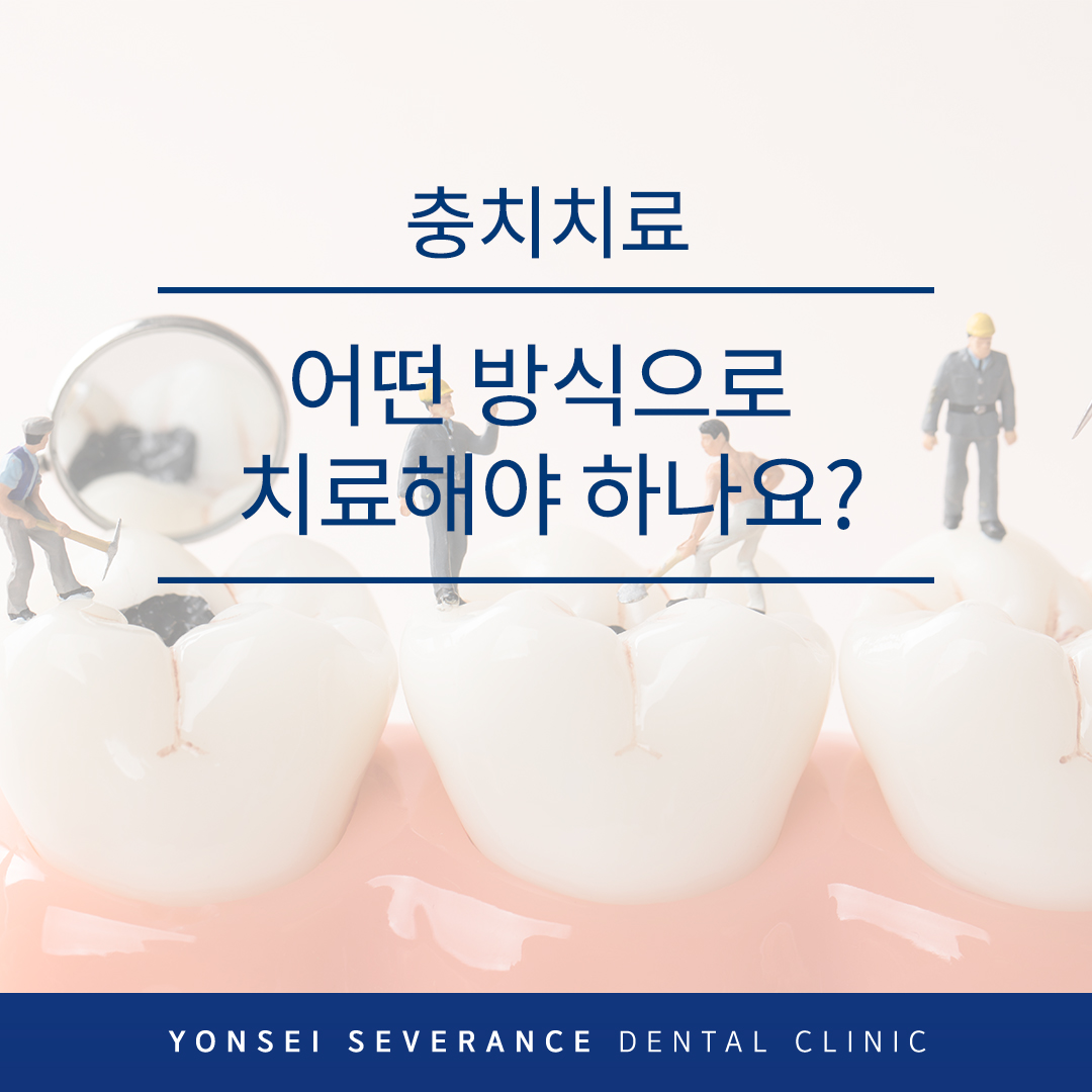 곡반정동충치치료
