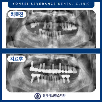 연세세브란스치과수원