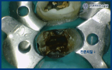 연세세브란스치과수원