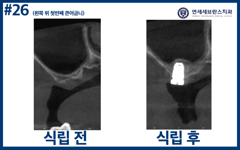 곡반정동치과