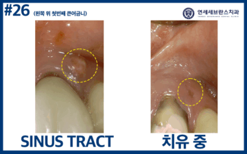 연세세브란스치과수원