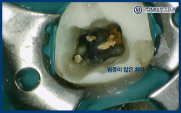 연세세브란스치과수원