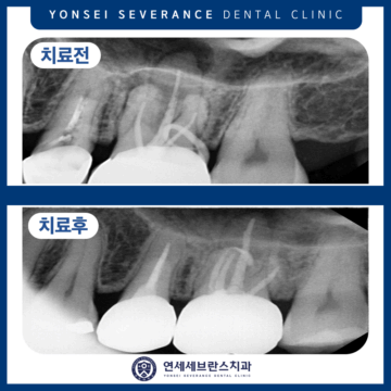 연세세브란스치과수원