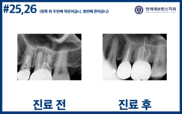 연세세브란스치과수원