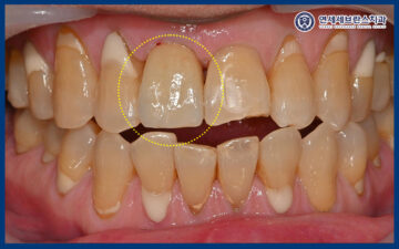 권선구임플란트