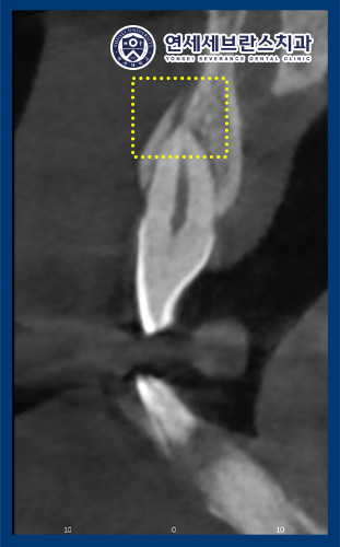 권선구임플란트