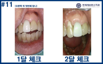 권선구임플란트