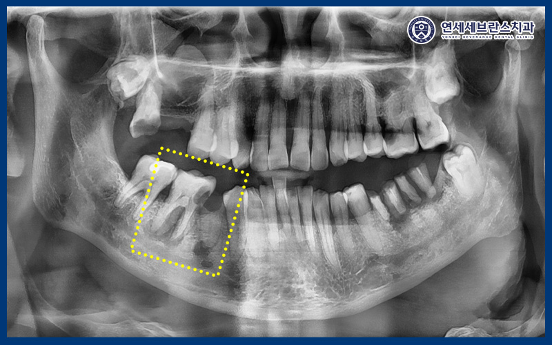 연세세브란스치과수원
