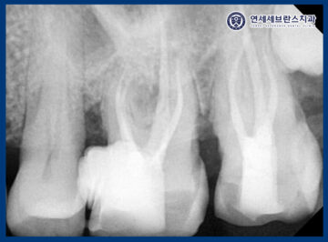 연세세브란스치과수원