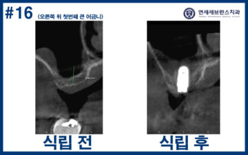 연세세브란스치과수원