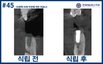 연세세브란스치과수원