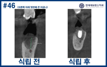 연세세브란스치과수원