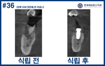 연세세브란스치과수원