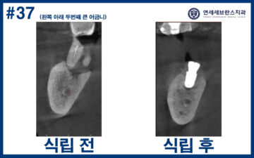 연세세브란스치과수원