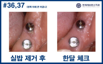 연세세브란스치과수원