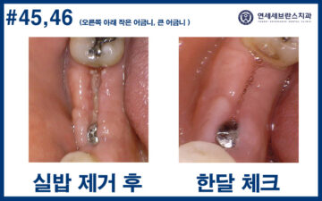연세세브란스치과수원