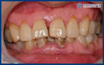 연세세브란스치과수원