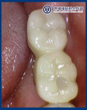 연세세브란스치과수원