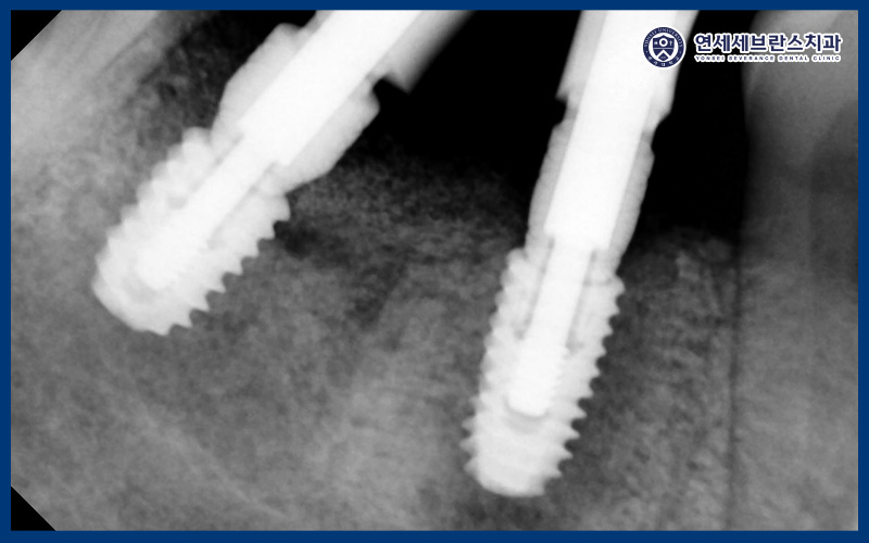 연세세브란스치과수원