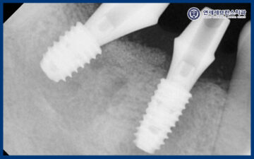 연세세브란스치과수원