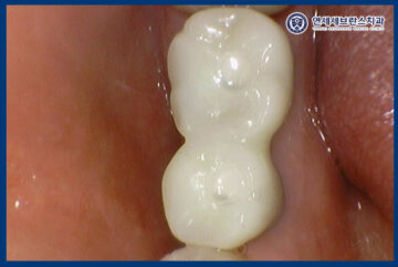 연세세브란스치과수원