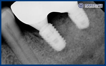 연세세브란스치과수원