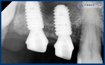 연세세브란스치과수원