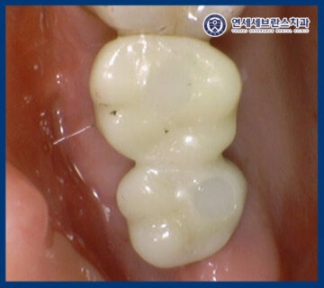 연세세브란스치과수원