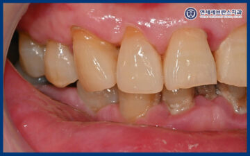 연세세브란스치과수원