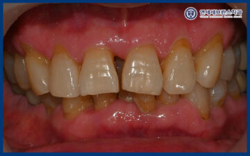 연세세브란스치과수원