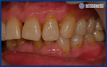 연세세브란스치과수원