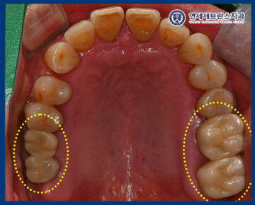 연세세브란스치과수원