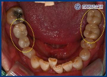 연세세브란스치과수원