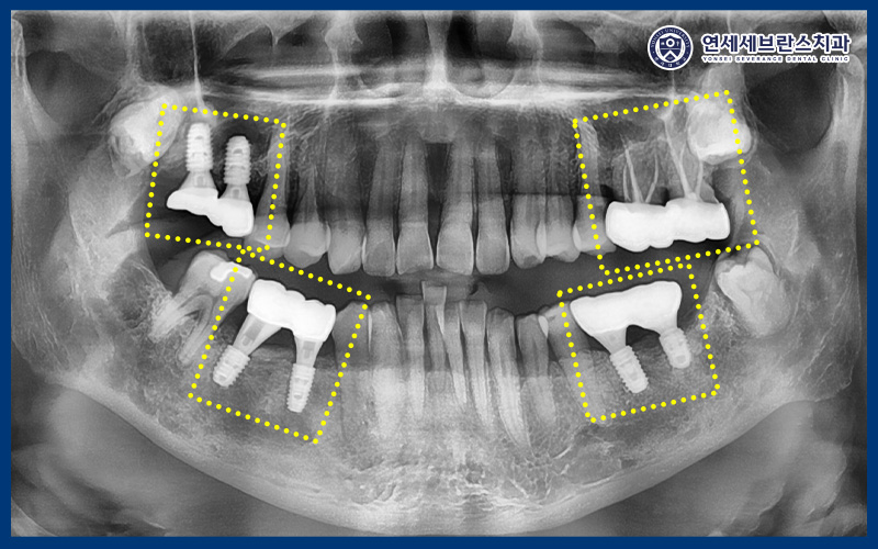 연세세브란스치과수원