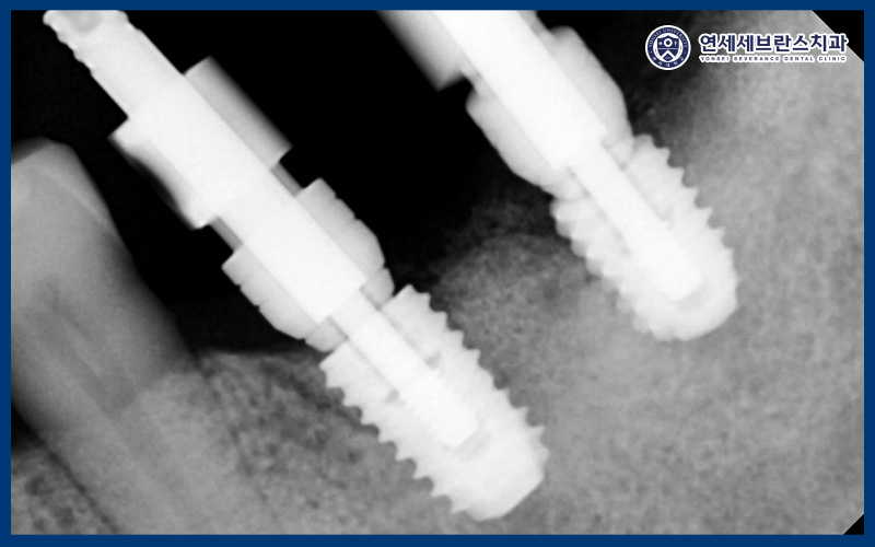 연세세브란스치과수원