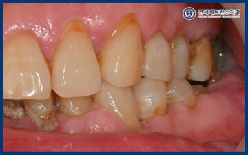 연세세브란스치과수원