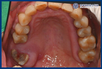 연세세브란스치과수원