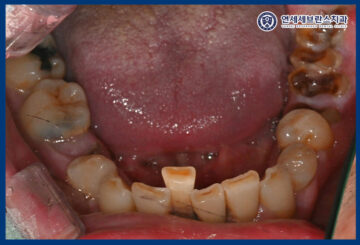 연세세브란스치과수원