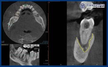 연세세브란스치과수원