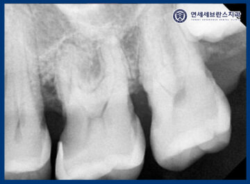 연세세브란스치과수원