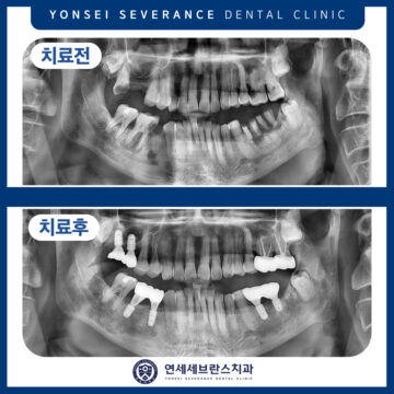 연세세브란스치과수원