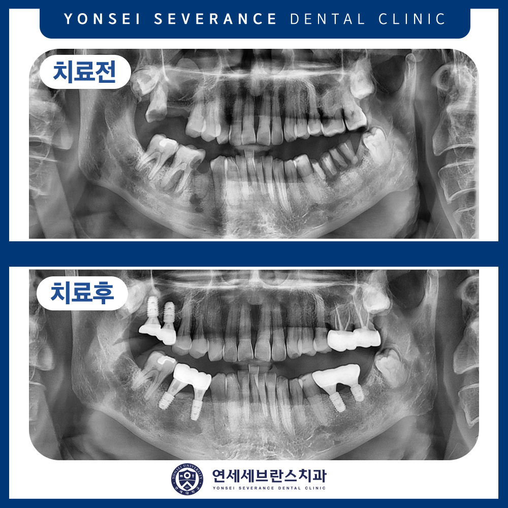 연세세브란스치과수원