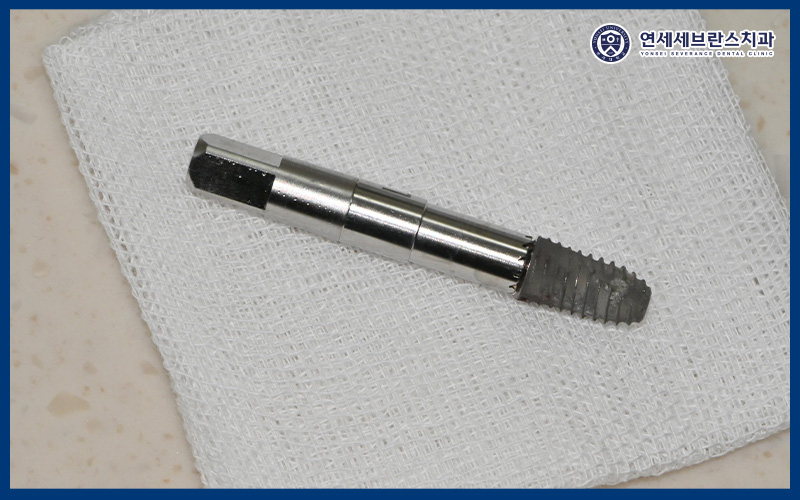 곡반정동임플란트