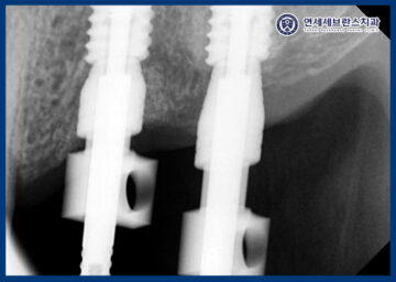 곡반정동치과