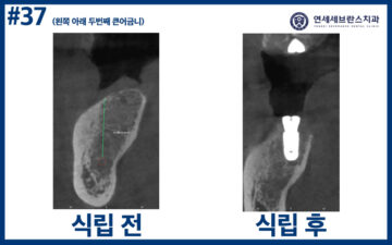 곡반정동치과
