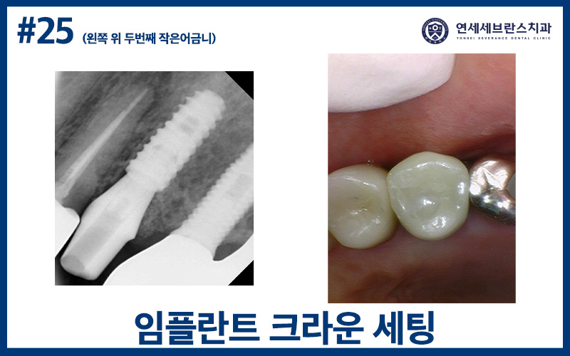 권선구치과