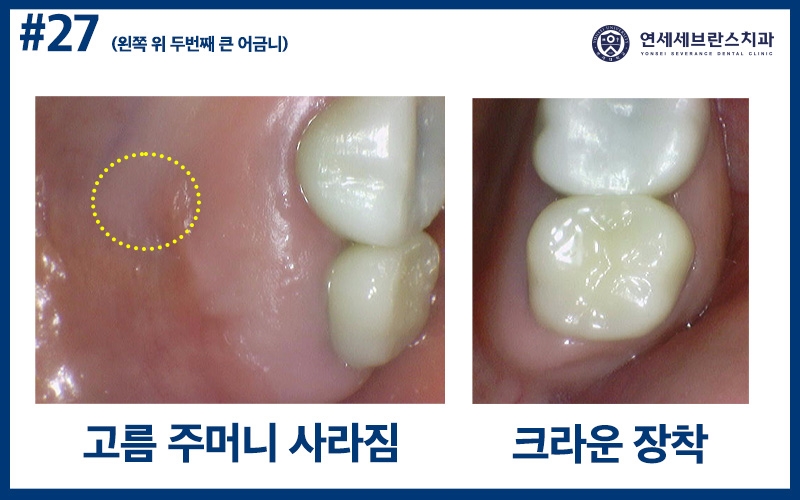곡반정동치과