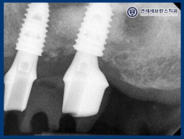 곡반정동치과